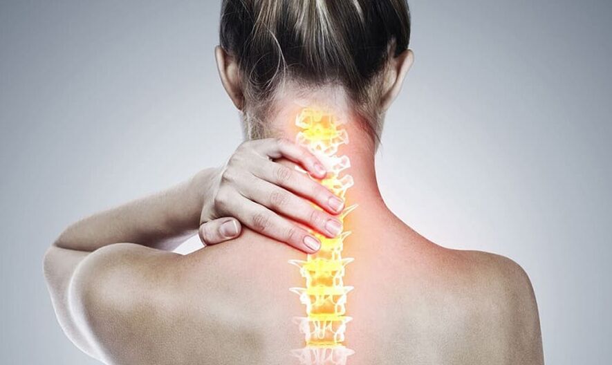 Osteochondroza odcinka szyjnego kręgosłupa